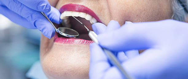 Best Emergency Tooth Extraction in Leonard, TX