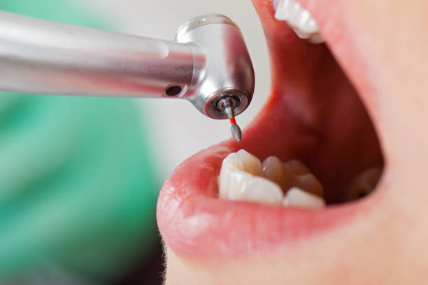 Best Emergency Dental Surgery in Leonard, TX